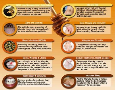 manuka honeycity